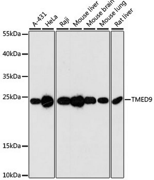 TMED9 Antibody in Western Blot (WB)