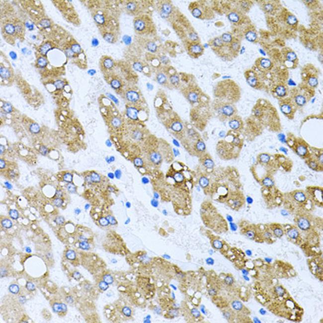 TOB2 Antibody in Immunohistochemistry (Paraffin) (IHC (P))