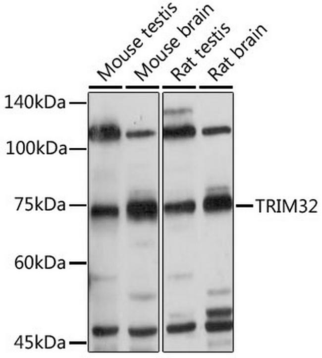 TRIM32 Antibody in Western Blot (WB)