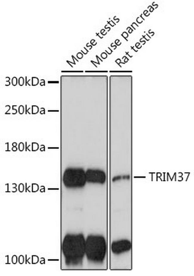 TRIM37 Antibody in Western Blot (WB)