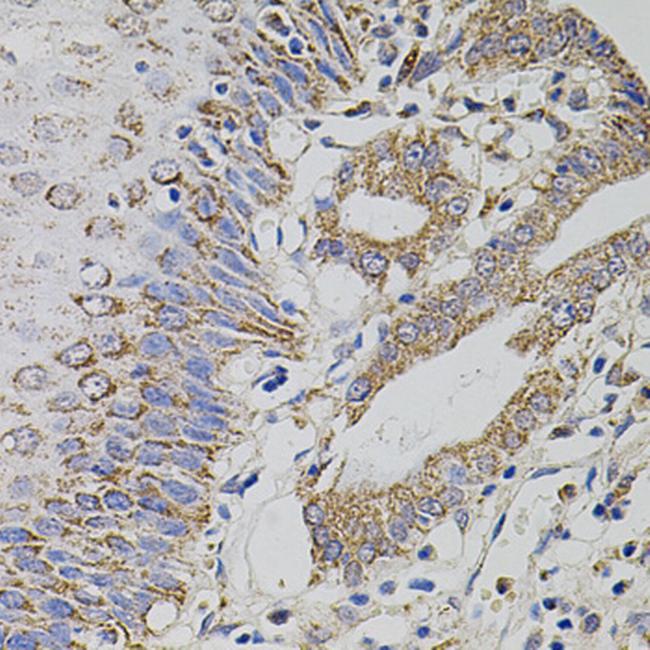 TRMT2A Antibody in Immunohistochemistry (Paraffin) (IHC (P))