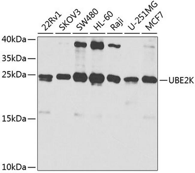 HIP2 Antibody in Western Blot (WB)