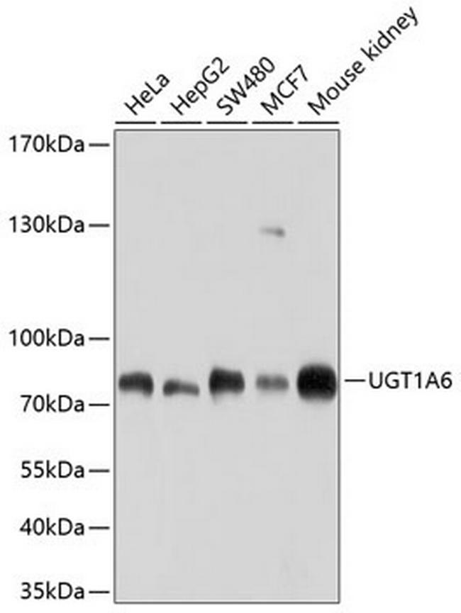 UGT1A6 Antibody in Western Blot (WB)