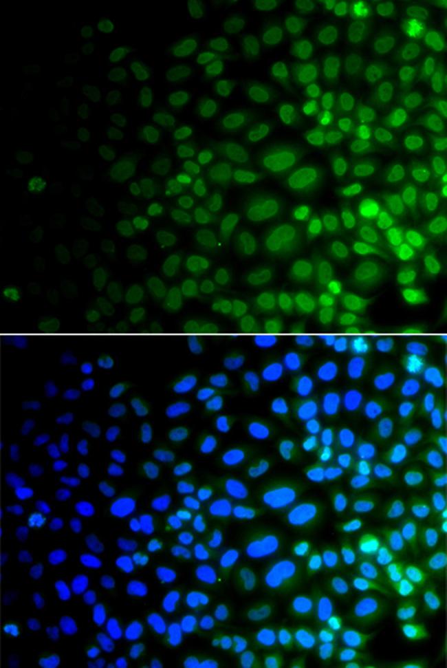 ULK4 Antibody in Immunocytochemistry (ICC/IF)