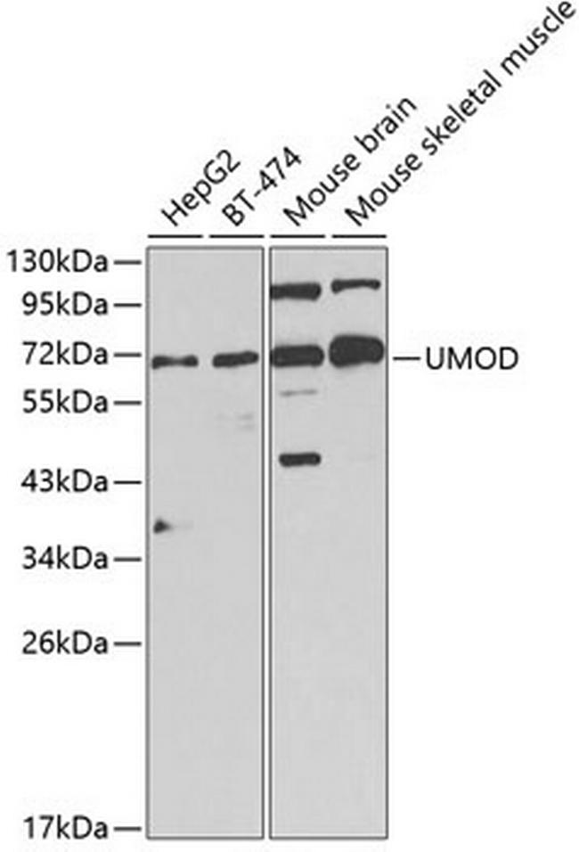 Uromodulin Antibody in Western Blot (WB)