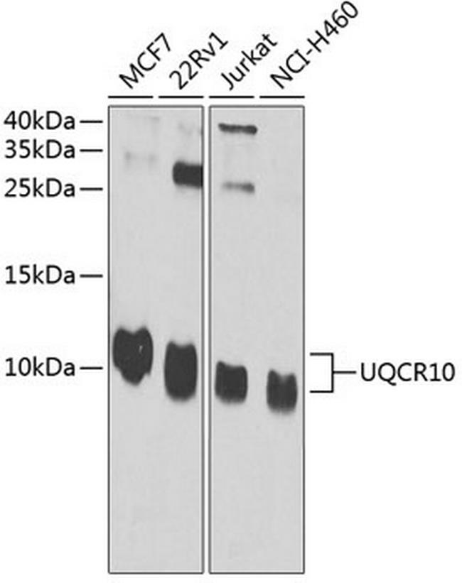 UCRC Antibody in Western Blot (WB)