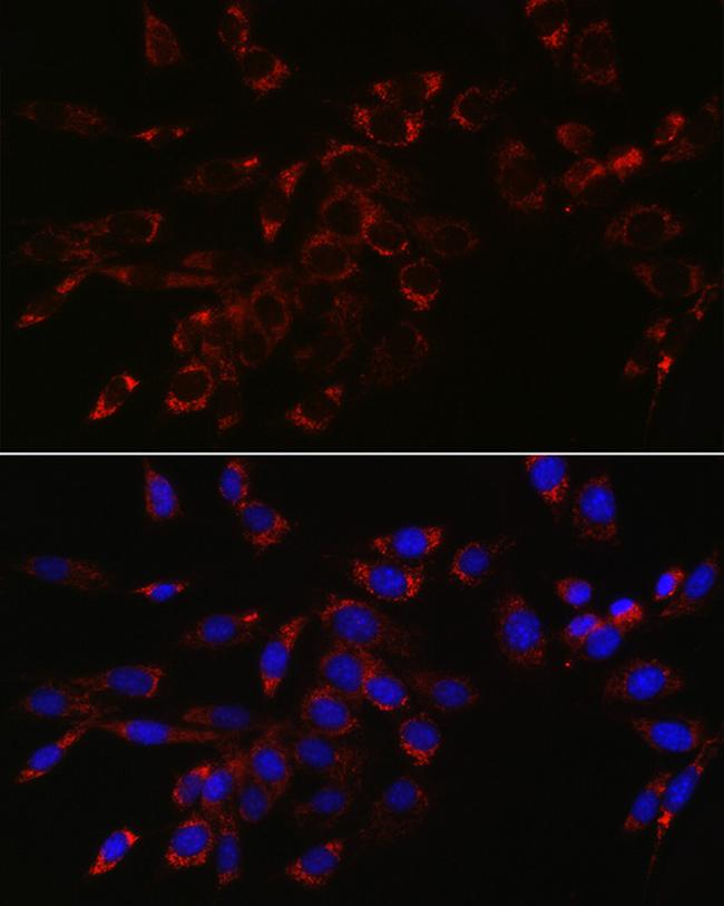 VPS4A Antibody in Immunocytochemistry (ICC/IF)