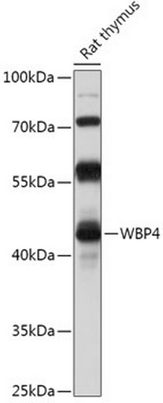 WBP4 Antibody in Western Blot (WB)