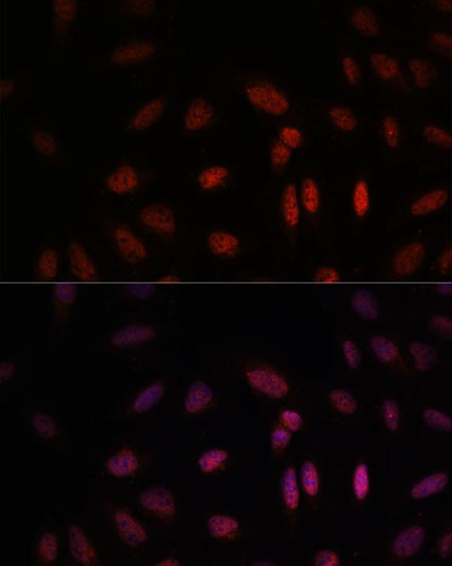 WDR18 Antibody in Immunocytochemistry (ICC/IF)