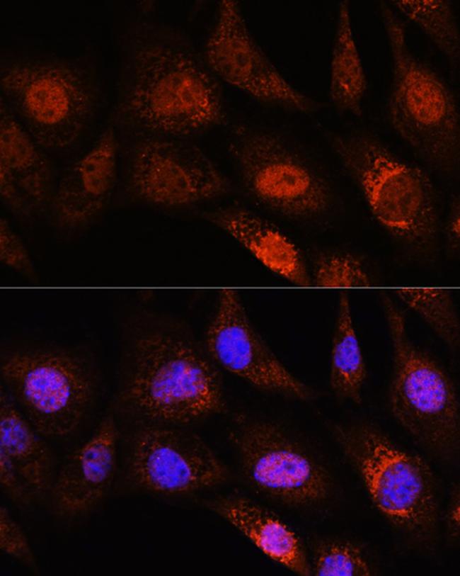 ZC3H12D Antibody in Immunocytochemistry (ICC/IF)