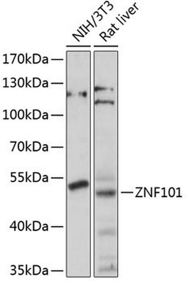 ZNF101 Antibody in Western Blot (WB)