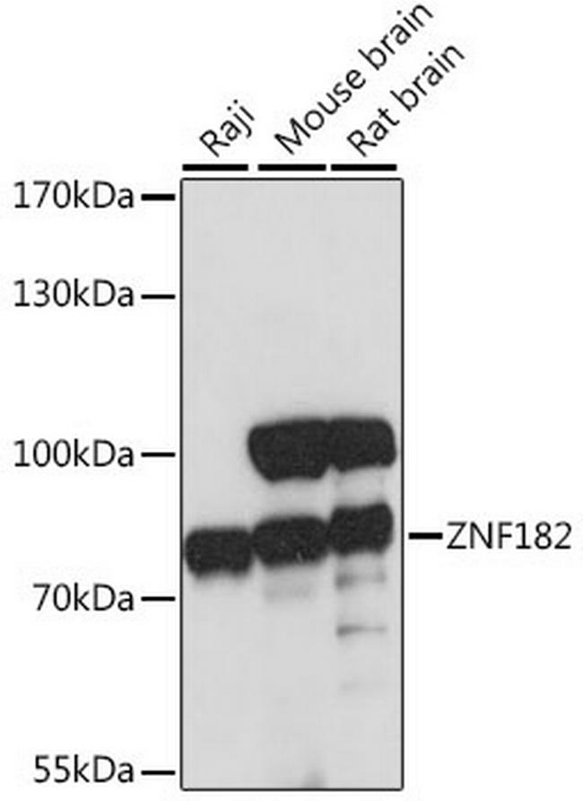 ZNF182 Antibody in Western Blot (WB)