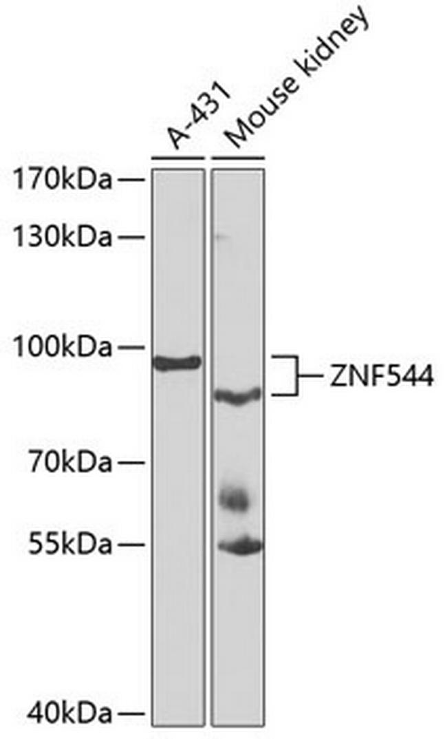 ZNF544 Antibody in Western Blot (WB)