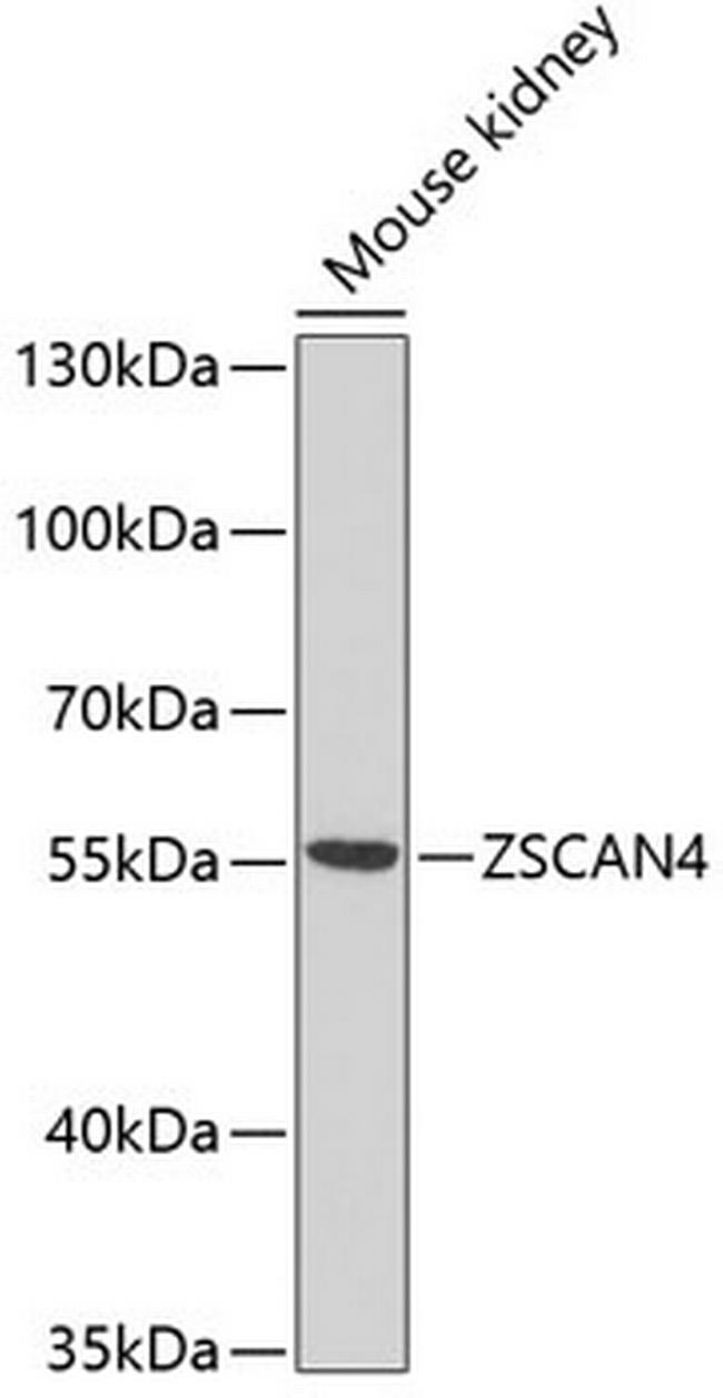 ZSCAN4C Antibody in Western Blot (WB)