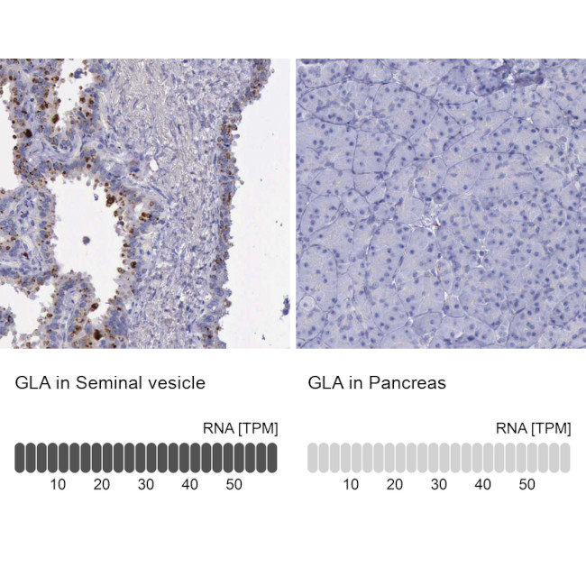 alpha Galactosidase Antibody in Immunohistochemistry (Paraffin) (IHC (P))