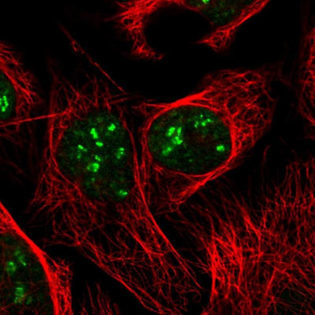 DKC1 Antibody in Immunocytochemistry (ICC/IF)