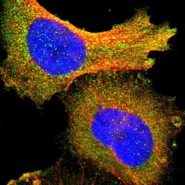 PI3K p85 alpha Antibody in Immunocytochemistry (ICC/IF)