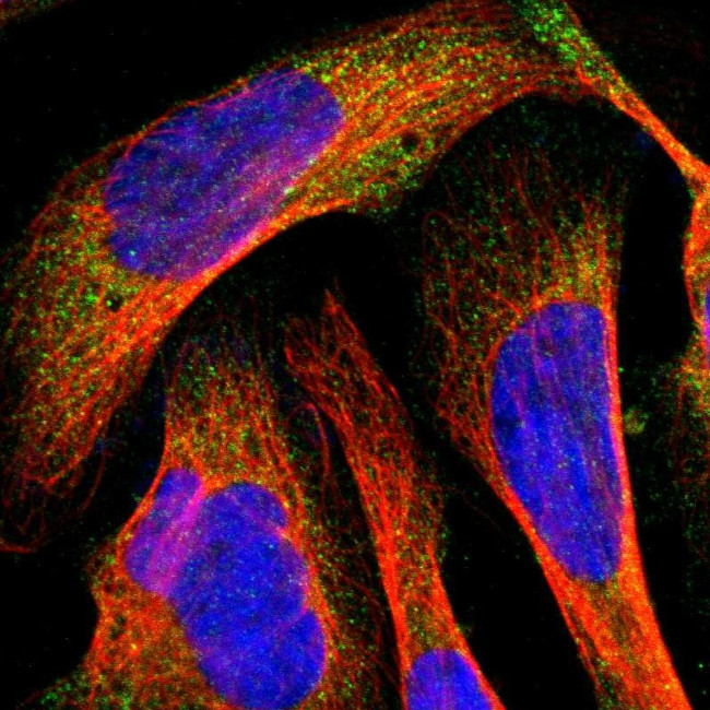 MMP9 Antibody in Immunocytochemistry (ICC/IF)