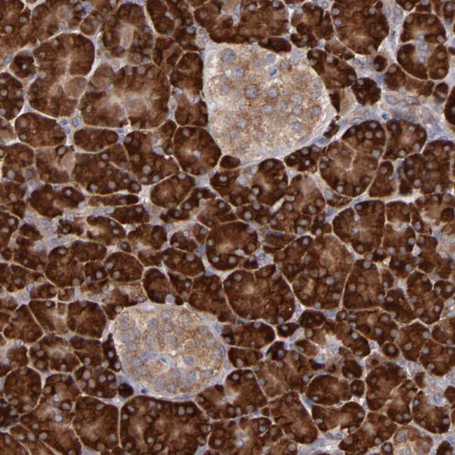 MTHFD1 Antibody in Immunohistochemistry (Paraffin) (IHC (P))