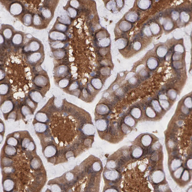 Syk Antibody in Immunohistochemistry (Paraffin) (IHC (P))