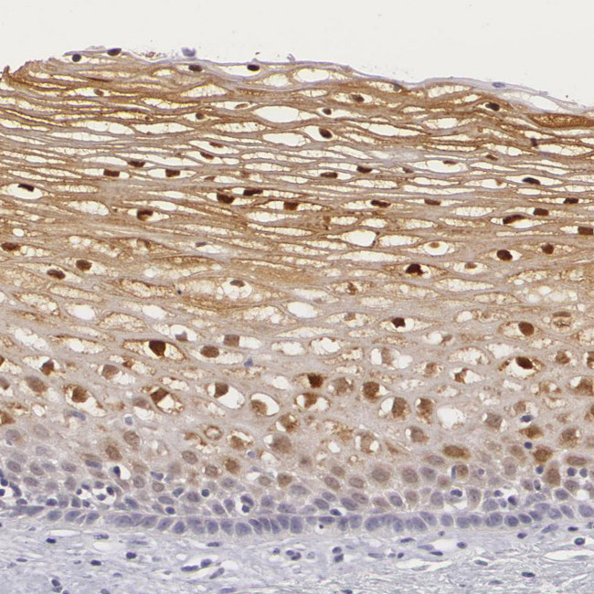 IL1RA Antibody in Immunohistochemistry (Paraffin) (IHC (P))