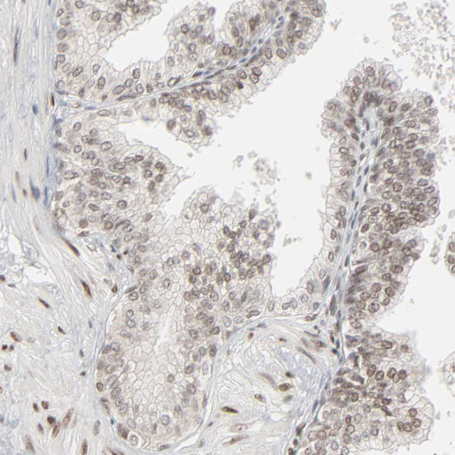 CUX1 Antibody in Immunohistochemistry (Paraffin) (IHC (P))