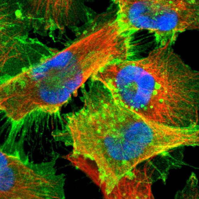 MCT1 Antibody in Immunocytochemistry (ICC/IF)