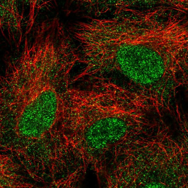 UBE2B Antibody in Immunocytochemistry (ICC/IF)