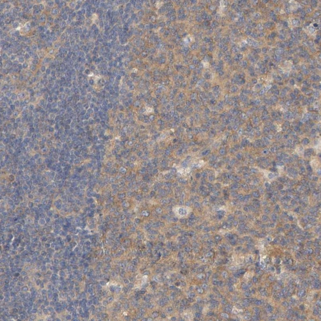 Carboxypeptidase B2 Antibody in Immunohistochemistry (Paraffin) (IHC (P))