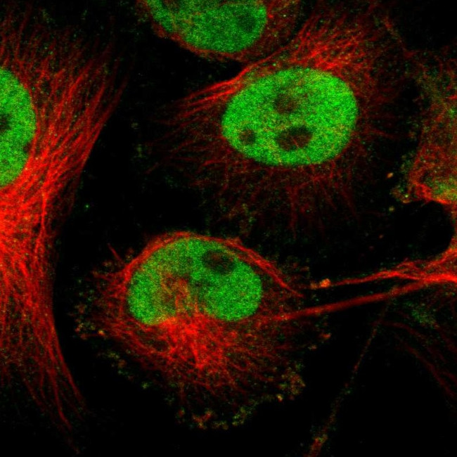 Fra2 Antibody in Immunocytochemistry (ICC/IF)