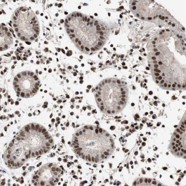 NBL1 Antibody in Immunohistochemistry (Paraffin) (IHC (P))