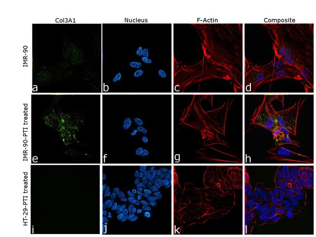 Collagen III Antibody in Immunocytochemistry (ICC/IF)