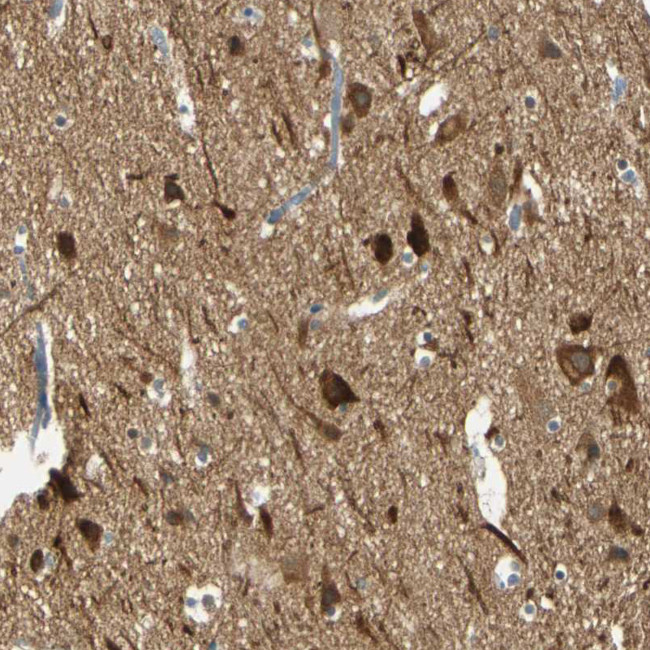 MAGI3 Antibody in Immunohistochemistry (Paraffin) (IHC (P))