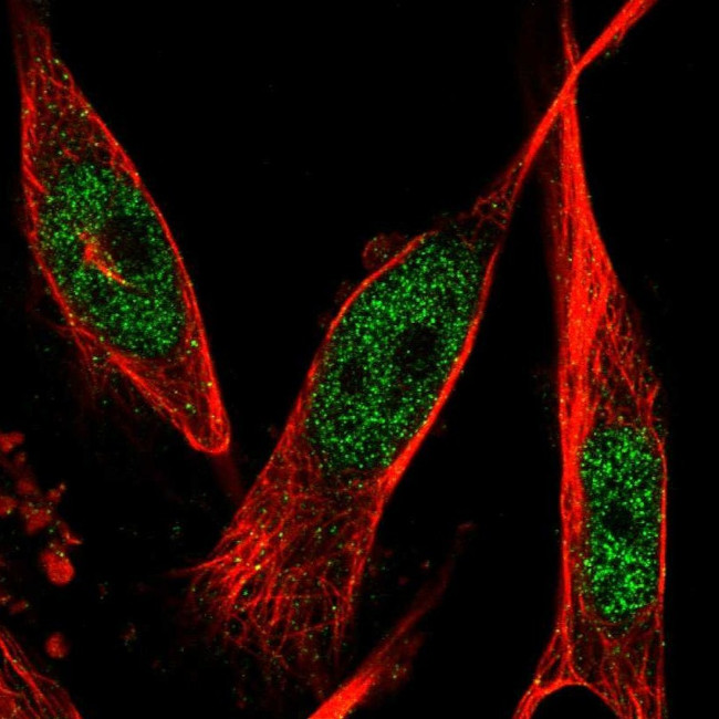 PFKFB3 Antibody in Immunocytochemistry (ICC/IF)