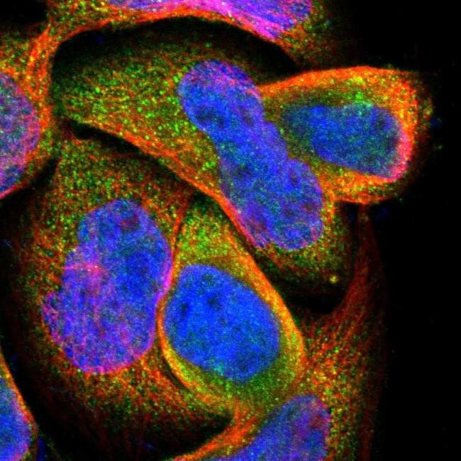 DPP8 Antibody in Immunocytochemistry (ICC/IF)