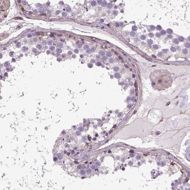 Amphiregulin Antibody in Immunohistochemistry (Paraffin) (IHC (P))