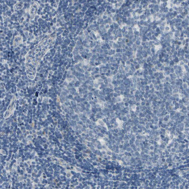 CNDP1 Antibody in Immunohistochemistry (Paraffin) (IHC (P))