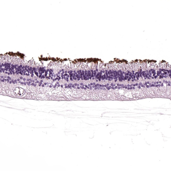 Rhodopsin Antibody in Immunohistochemistry (Paraffin) (IHC (P))