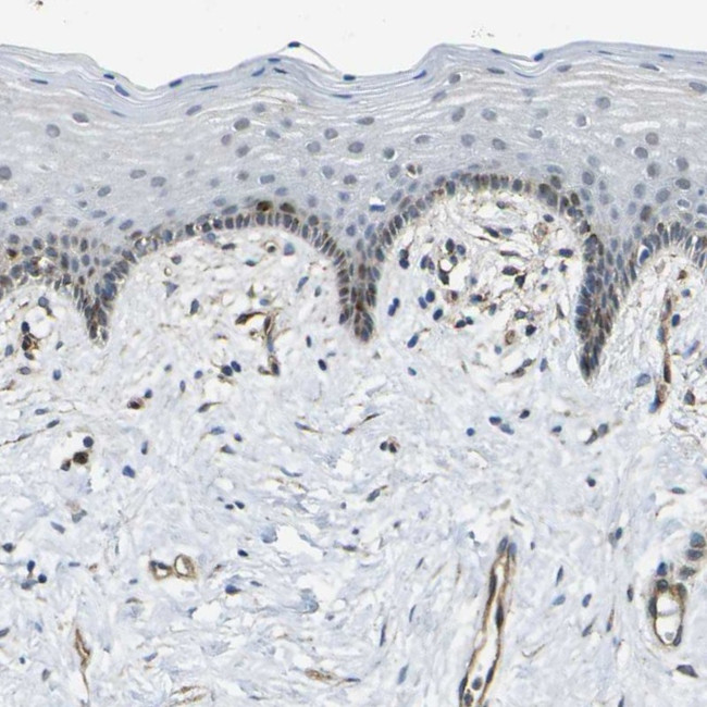 ECE1 Antibody in Immunohistochemistry (Paraffin) (IHC (P))