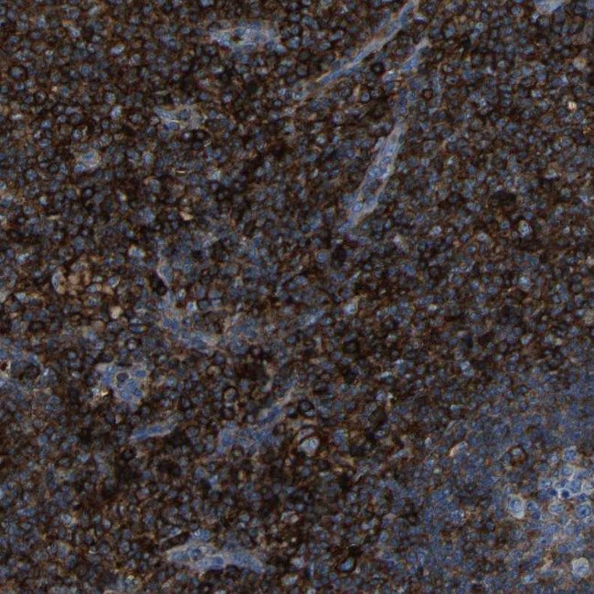 CD97 Antibody in Immunohistochemistry (Paraffin) (IHC (P))