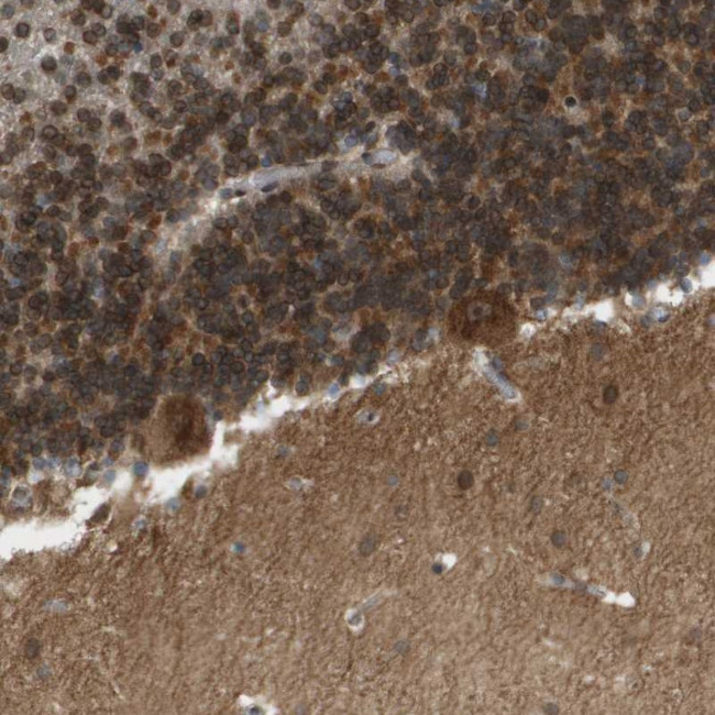 Calcium Channel beta-4 Antibody in Immunohistochemistry (Paraffin) (IHC (P))