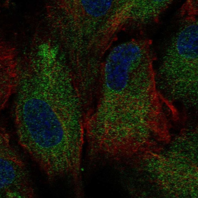 PKD2 Antibody in Immunocytochemistry (ICC/IF)