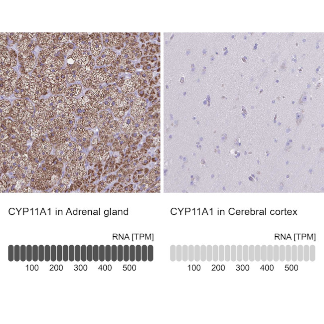 CYP11A1 Antibody in Immunohistochemistry (Paraffin) (IHC (P))