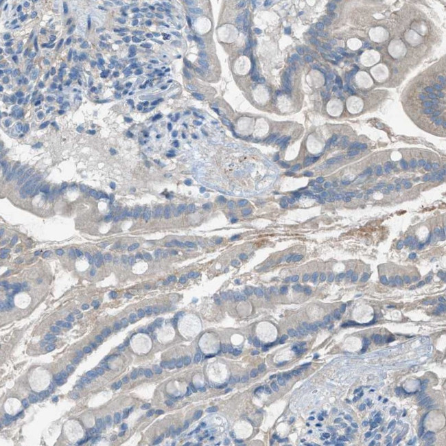 GPR77 Antibody in Immunohistochemistry (Paraffin) (IHC (P))