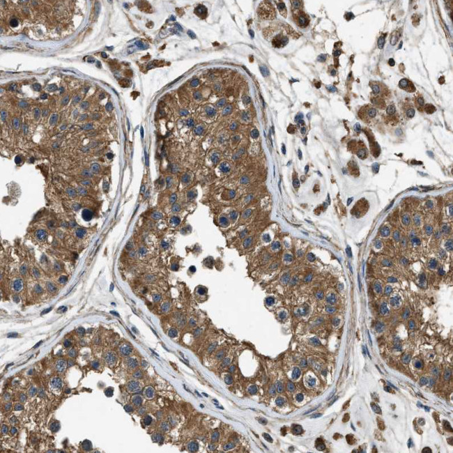 YARS Antibody in Immunohistochemistry (Paraffin) (IHC (P))