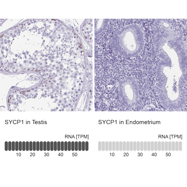 SCP1 Antibody in Immunohistochemistry (Paraffin) (IHC (P))