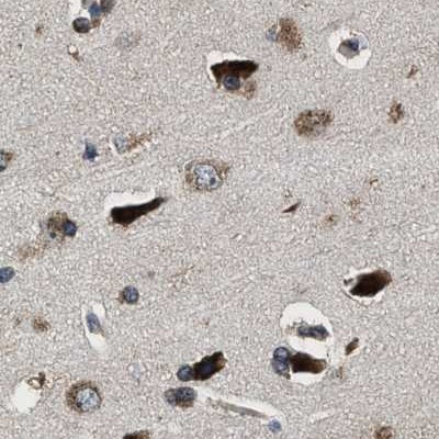 RCAS1 Antibody in Immunohistochemistry (Paraffin) (IHC (P))