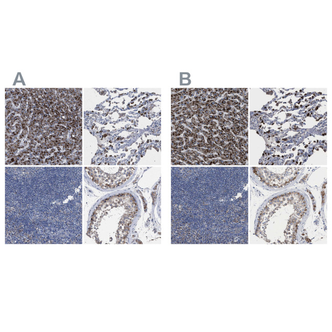 HSD17B4 Antibody in Immunohistochemistry (Paraffin) (IHC (P))