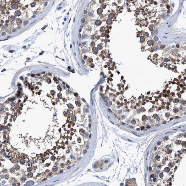 CALCOCO2 Antibody in Immunohistochemistry (Paraffin) (IHC (P))