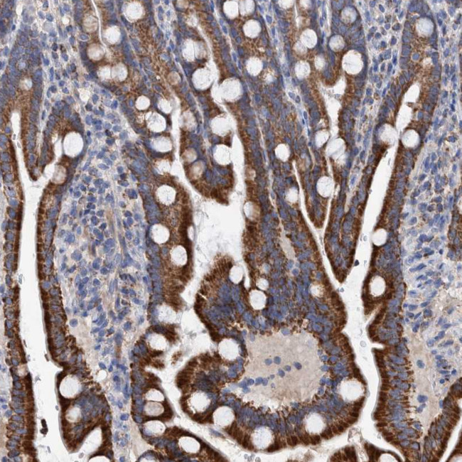 DECR1 Antibody in Immunohistochemistry (Paraffin) (IHC (P))